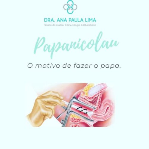 Exame Papanicolau