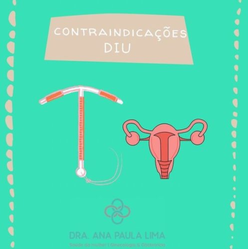 Contraindicações DIU Hormonal